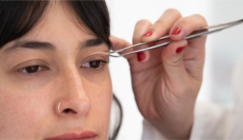 Preguntas frecuentes sobre la blefaroplastia